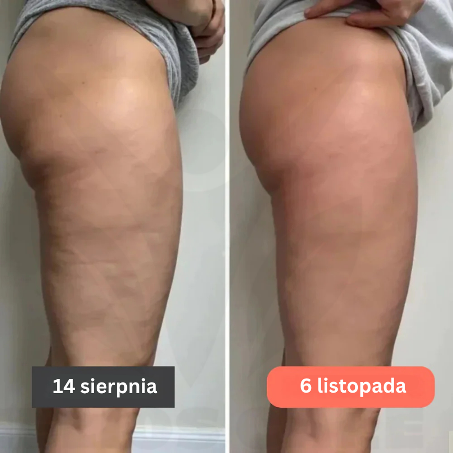 BodyFit™ – Legginsy 3D push-up antycellulitowe