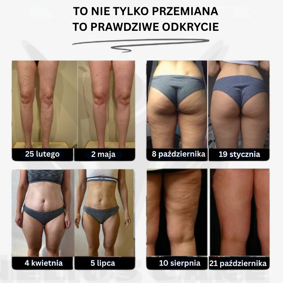 BodyFit™ – Legginsy 3D push-up antycellulitowe