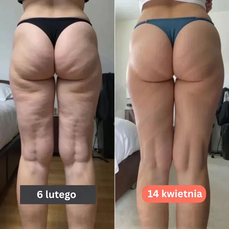 BodyFit™ – Legginsy 3D push-up antycellulitowe