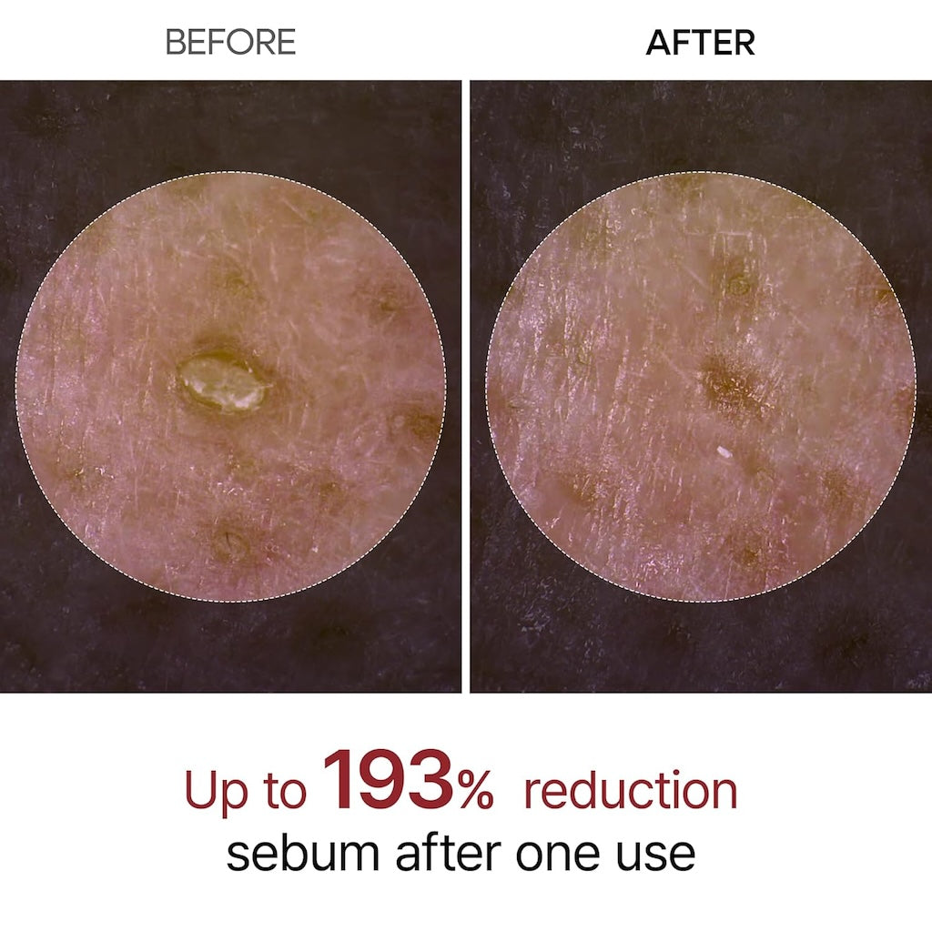 Peel Shot Glow Rice Ampoule Duo