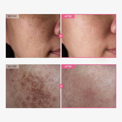 Krem rozjaśniający „Arbutyna 7% + TXA 4%” dla wzmocnienia bariery skórnej