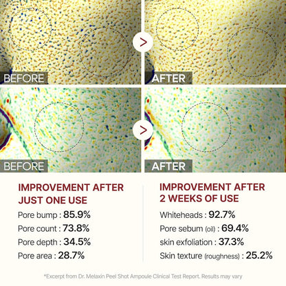 Peel Shot Glow Rice Ampoule Duo