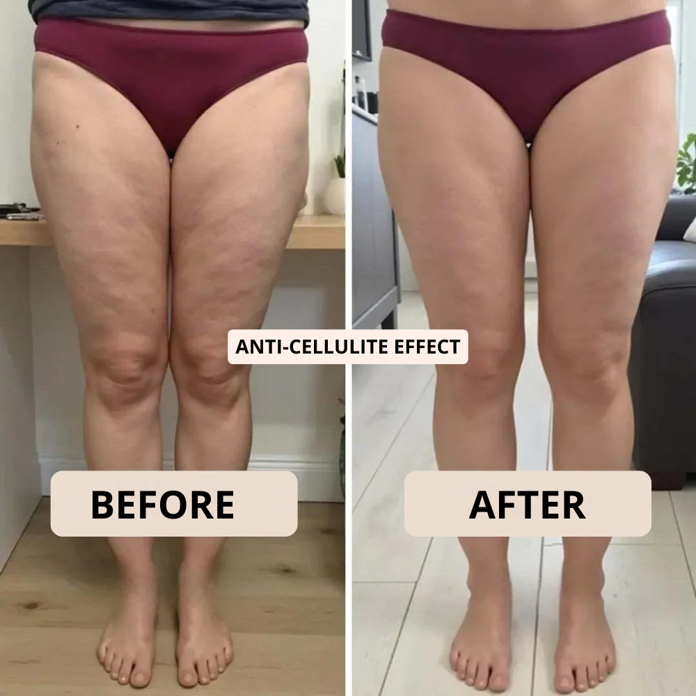 BodyFIt™ | Spodenki 3D Metabolic Booster