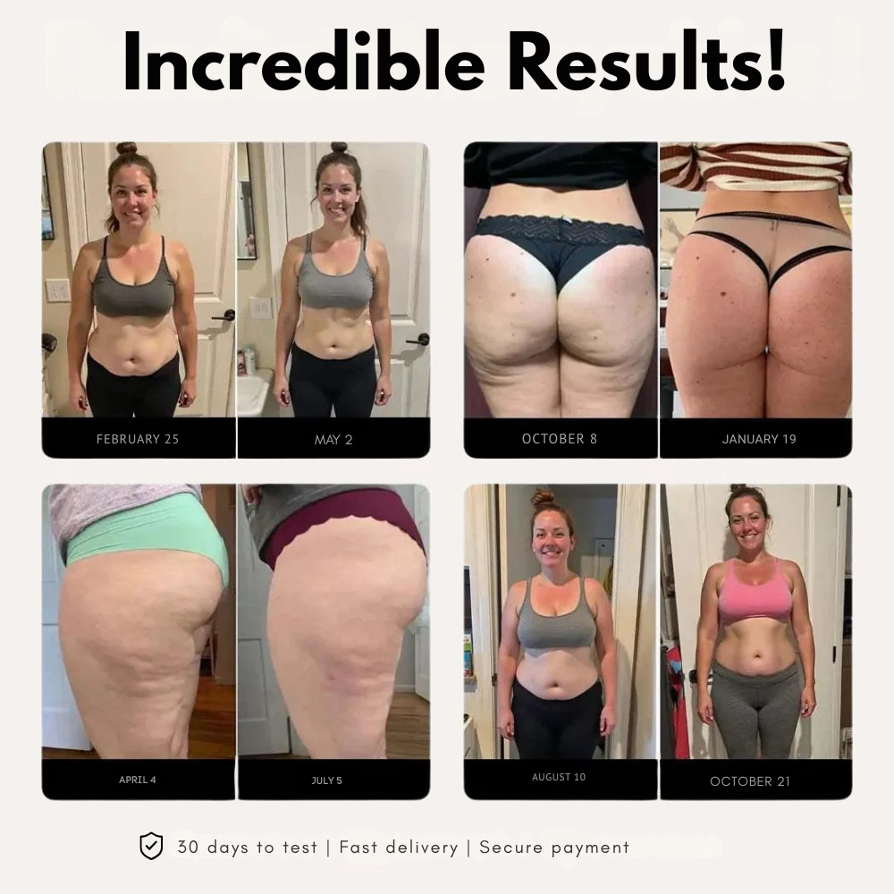 BodyFIt™ | Spodenki 3D Metabolic Booster