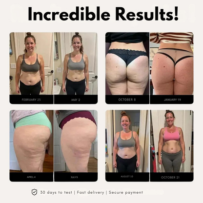 BodyFIt™ | Spodenki 3D Metabolic Booster